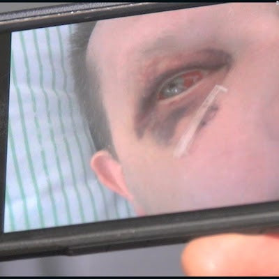 Το AfD κερδίζει μεγάλη υποστήριξη από ένα μάλλον απροσδόκητο μέρος: Tην κοινότητα των ομοφυλόφιλων (βίντεο)